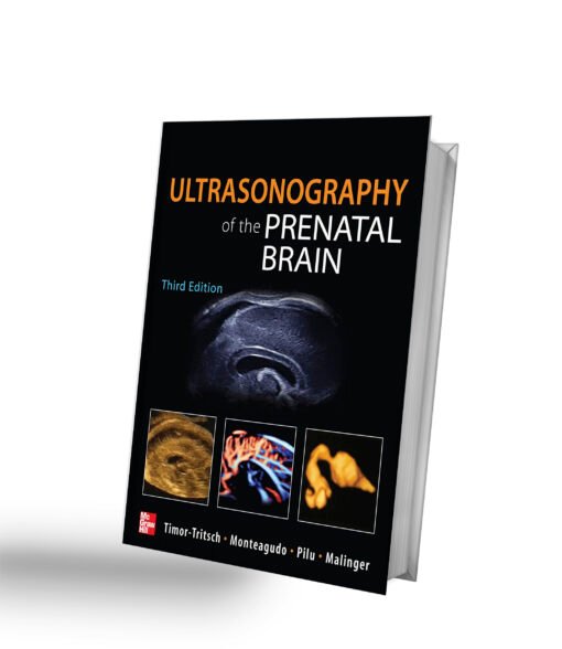 Ultrasonography of the Prenatal Brain, Third Edition 3rd Edition