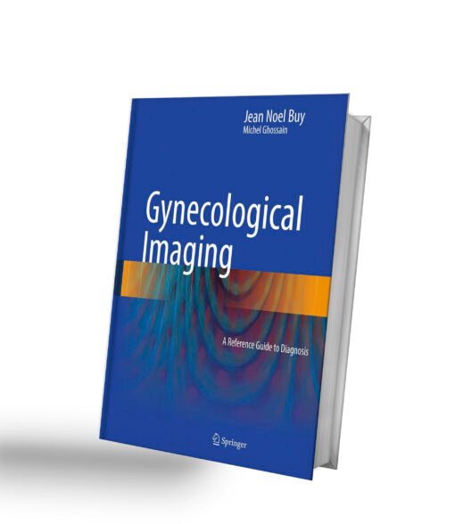 Gynecological Imaging: A Reference Guide to Diagnosis 2013th Edition