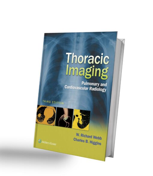 Thoracic Imaging: Pulmonary and Cardiovascular Radiology 3rd Edition