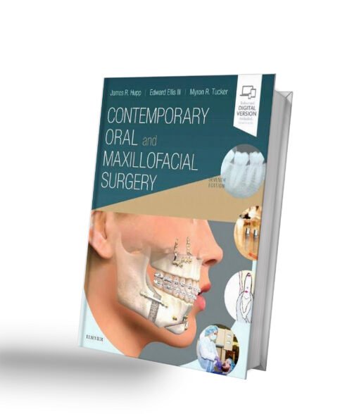 Contemporary Oral and Maxillofacial Surgery 7th Edition