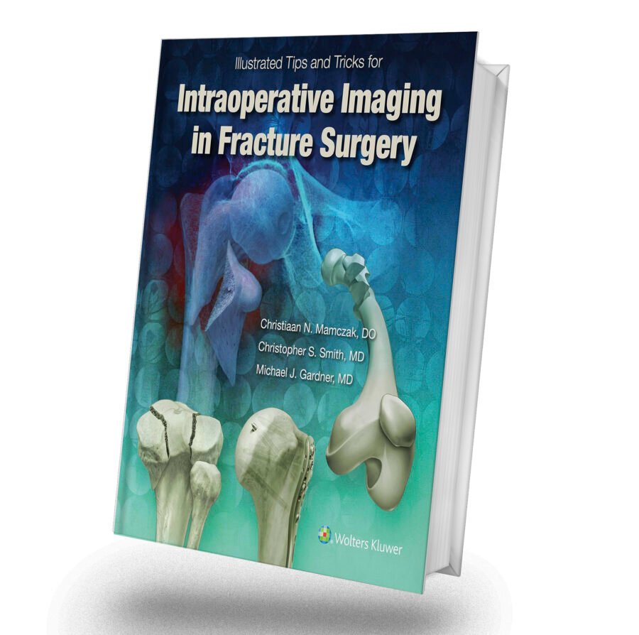 Illustrated Tips and Tricks for Intraoperative Imaging in Fracture Surgery First Edition